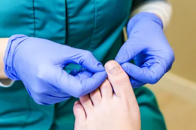 Podolog Gdańsk | Instytut Podologii Suela | Gabinet podologiczny Gdańsk | Wrastające paznokcie | Odciski